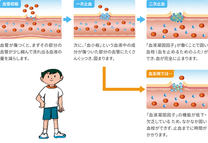 出血したときに血が止まるしくみ